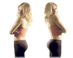 lipofilling fessier avant apres 