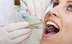hollywood smile tunisie
